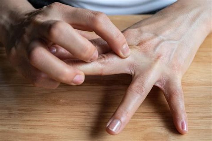 What happens to your fingers when you type too much?