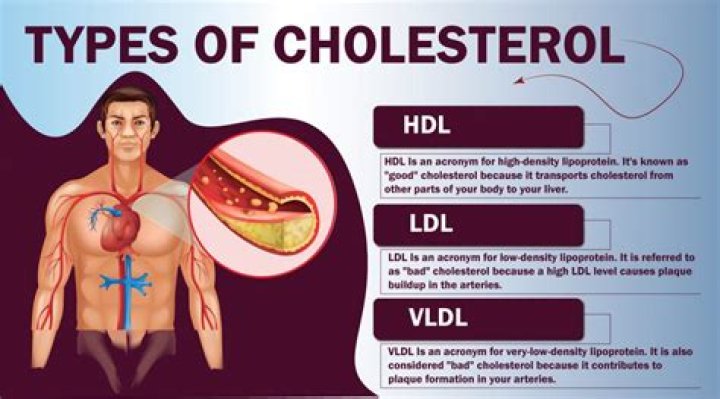 What is dangerously high cholesterol?